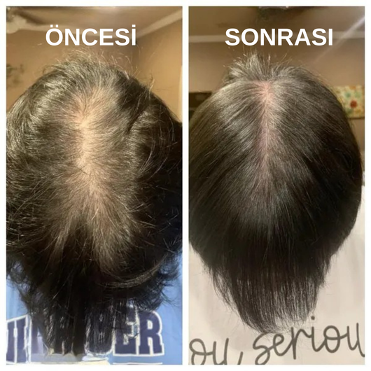 Sofel™ Pirinç Suyu Proteini: Hızlı Uzama & Dökülme Karşıtı Konsantre Şampuan Barı