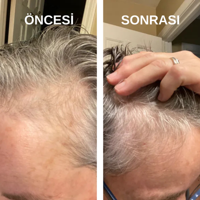 Sofel™ Pirinç Suyu Proteini: Hızlı Uzama & Dökülme Karşıtı Konsantre Şampuan Barı