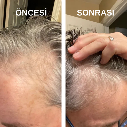 Sofel™ Pirinç Suyu Proteini: Hızlı Uzama & Dökülme Karşıtı Konsantre Şampuan Barı