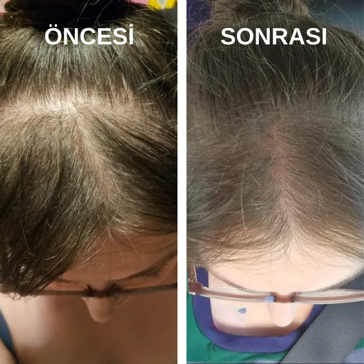 Sofel™ Pirinç Suyu Proteini: Hızlı Uzama & Dökülme Karşıtı Konsantre Şampuan Barı